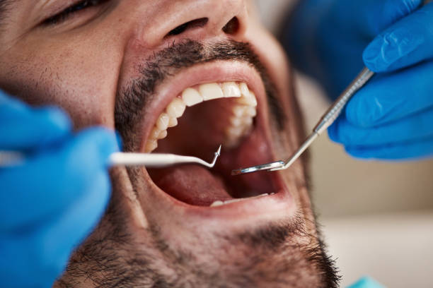 Best Tooth Infection Emergency Dentist  in Royse City, TX